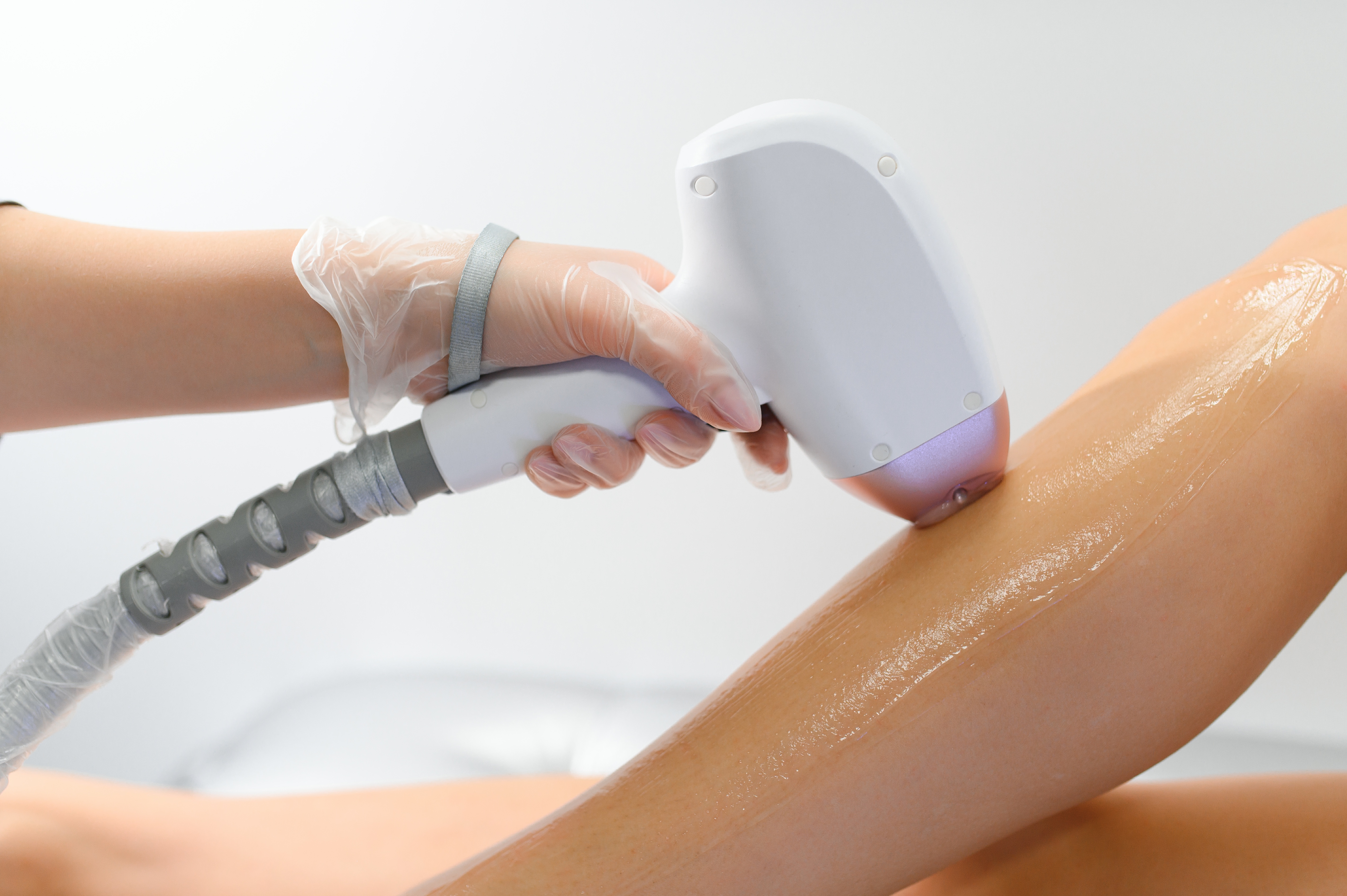 Depilación láser corporal en centro de estética en Arenys de Mar